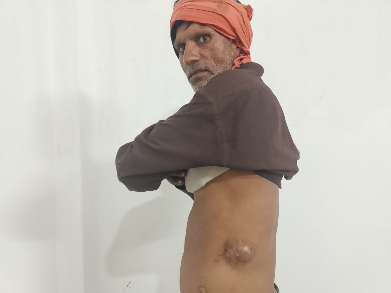 “मधेसको अधिकारका लागि लडेँ, अहिले परिवार पाल्न संघर्ष गर्दैछु” मधेस आन्दोलनका योद्धा पटेल